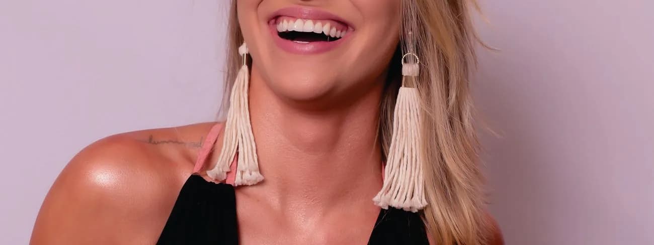 Acessórios